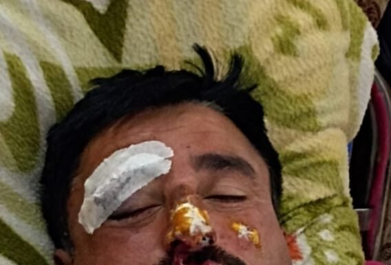 नैनीताल- स्मैक तस्कर का पीछा करते पुलिस कर्मी मनोज जोशी हुए घायल